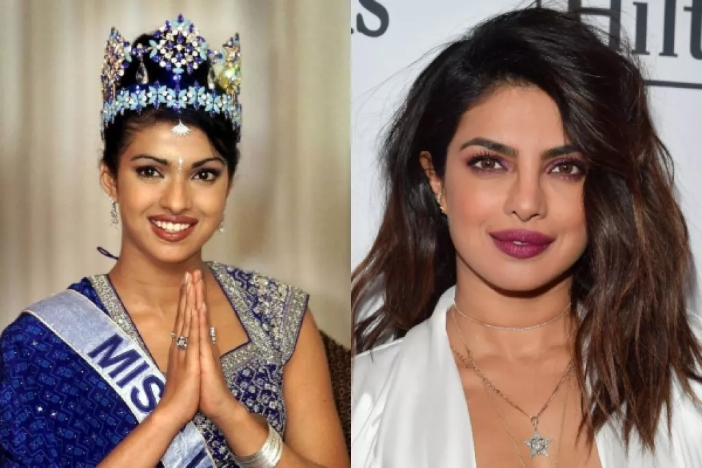 20 Divas Who Underwent Cosmetic Surgery To Enhance Beauty: Priyanka ...