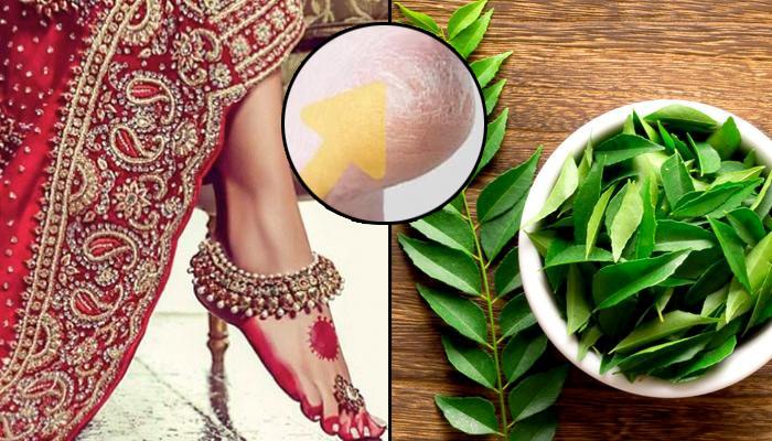 8 remedies for cracked heels and what causes them | GoodtoKnow