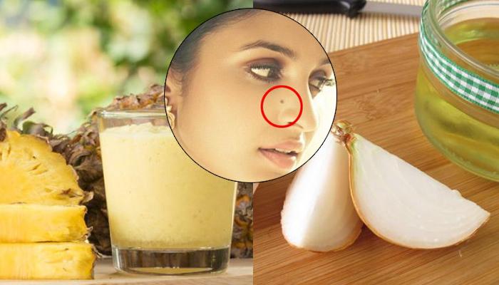 PINEAPPLE OIL/ How to Make Pineapple oil at home for skin lightening/ Pineapple  oil benefits 