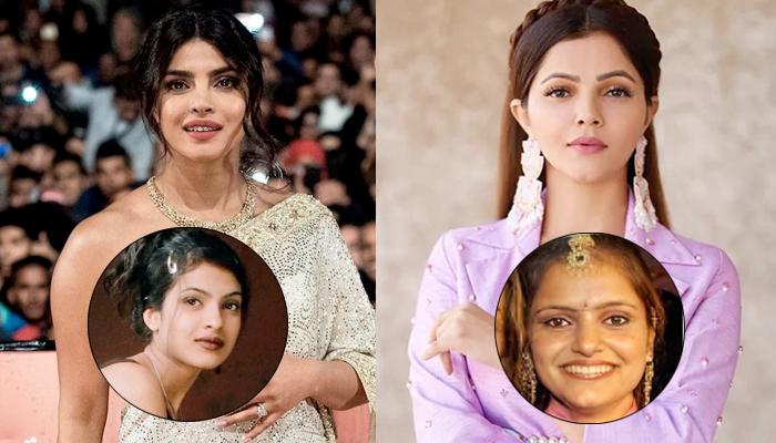20 Divas Who Underwent Cosmetic Surgery To Enhance Beauty: Priyanka Chopra  To Rubina Dilaik