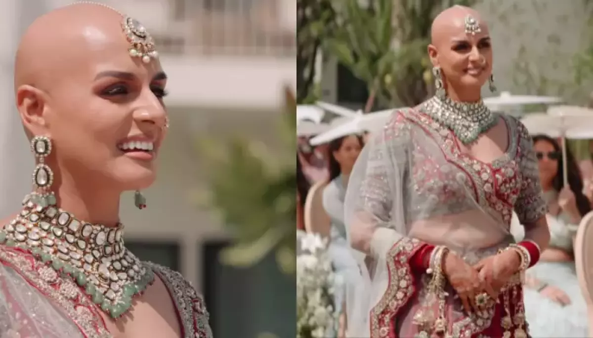 Indian Bride Flaunts Her Baldness, Ditches Wig And Opts For A ‘Maang Teeka’ For Her Big Day